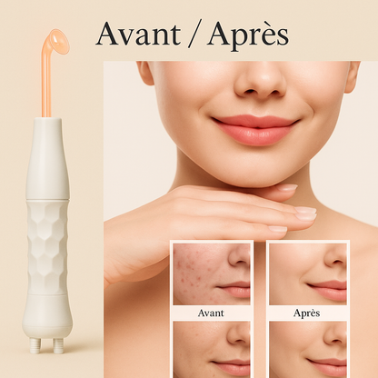 lumea-appareil haute fréquence